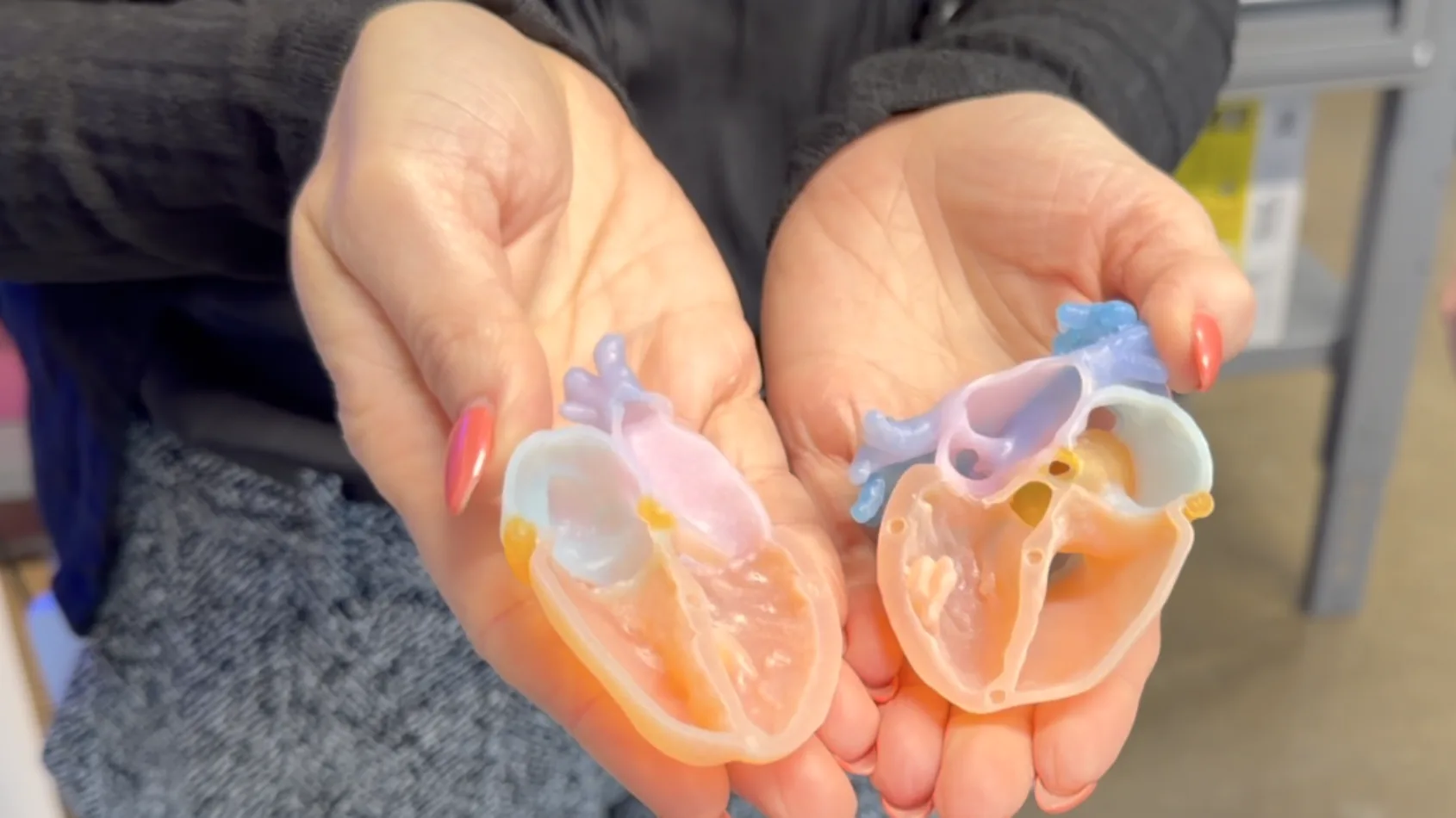 IU Health opens FDA-cleared 3D print studio for faster surgery planning