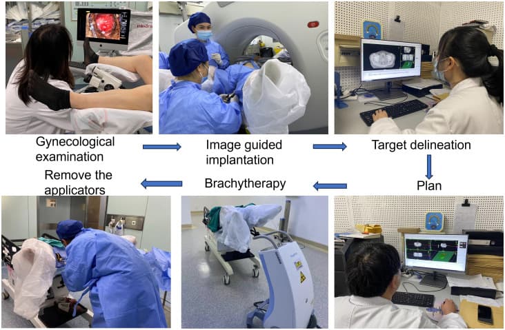Kelowna team prints patient-specific brachytherapy applicators with 3D printers
