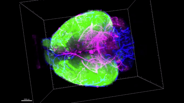 Brain waste follows region-specific exit routes, study finds
