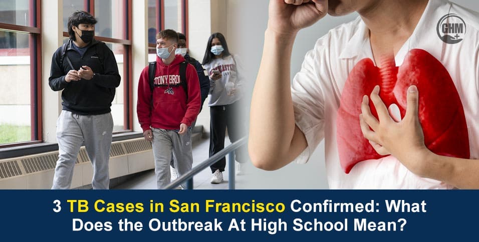 San Francisco school TB outbreak expands, 18% of those tested infected