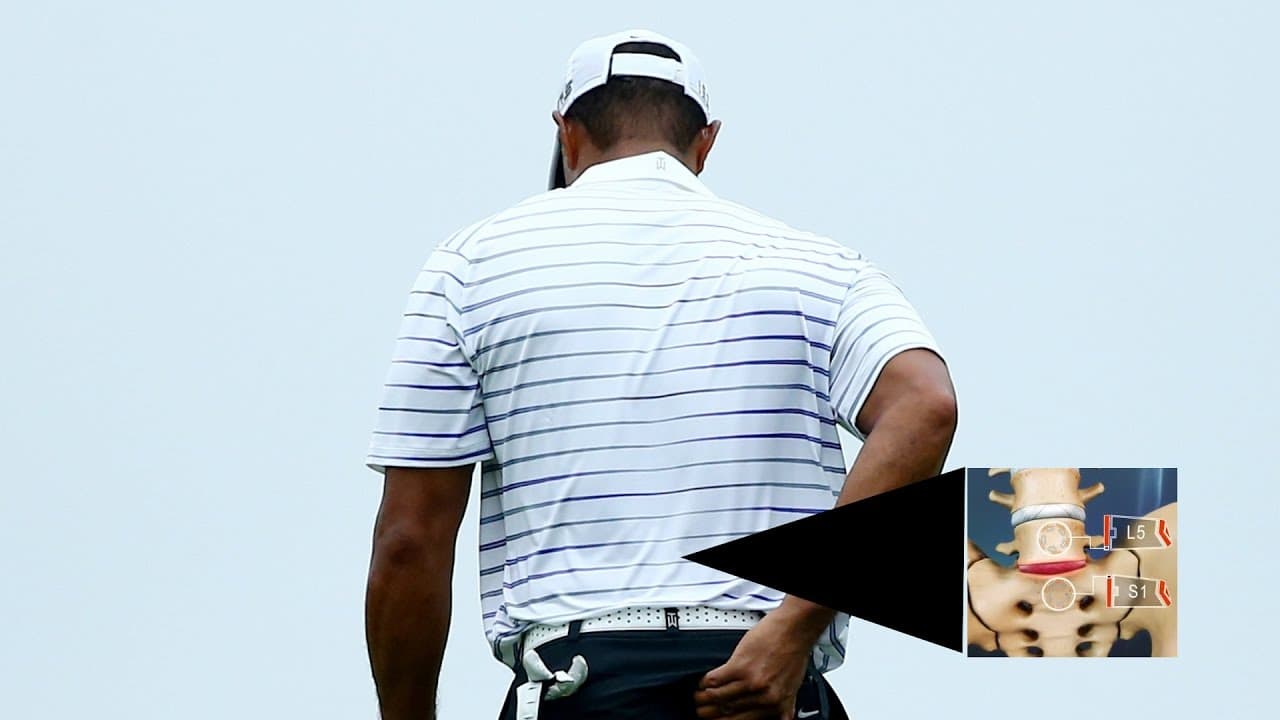 Tiger Woods Undergoes Seventh Back Surgery to Replace Damaged Disc