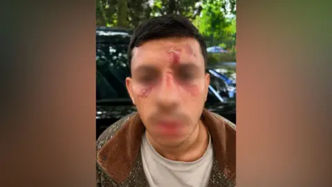 Police treat Golders Green assault on Jewish man as hate crime
