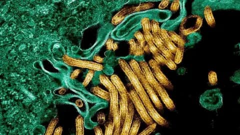 Africa CDC confirms Ebola outbreak in Congo’s Ituri province