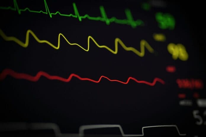 Keys AHEC offers free ECG screenings for Monroe student-athletes