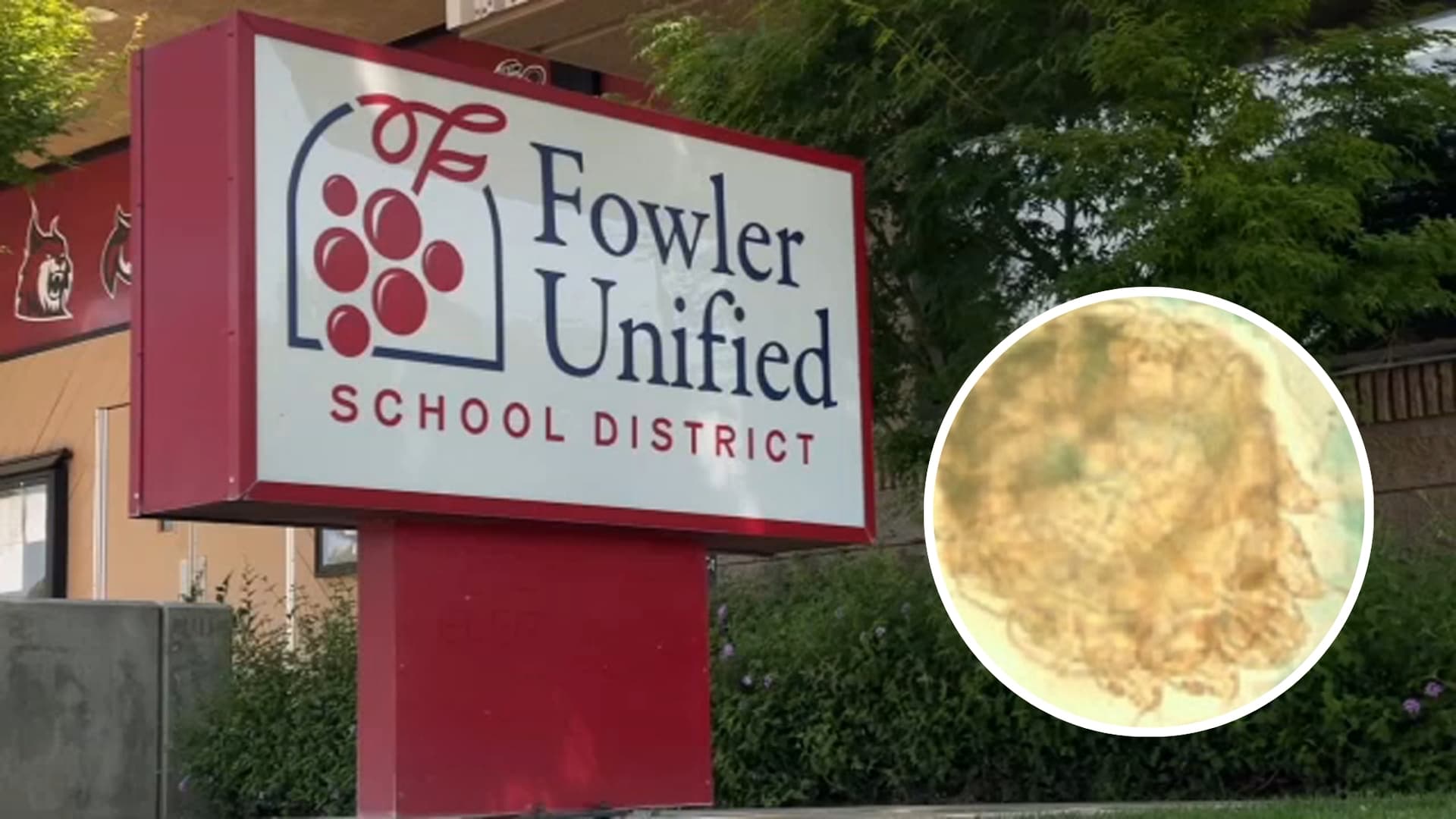Fowler school scabies outbreak contained, five cases confirmed by officials
