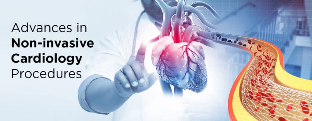 Greensboro Cone Health Doctor Discusses Noninvasive Heart Treatments for American Heart Month