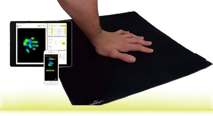 SFU uses pressure-mapping and AI to 3D-print custom prosthetic sockets