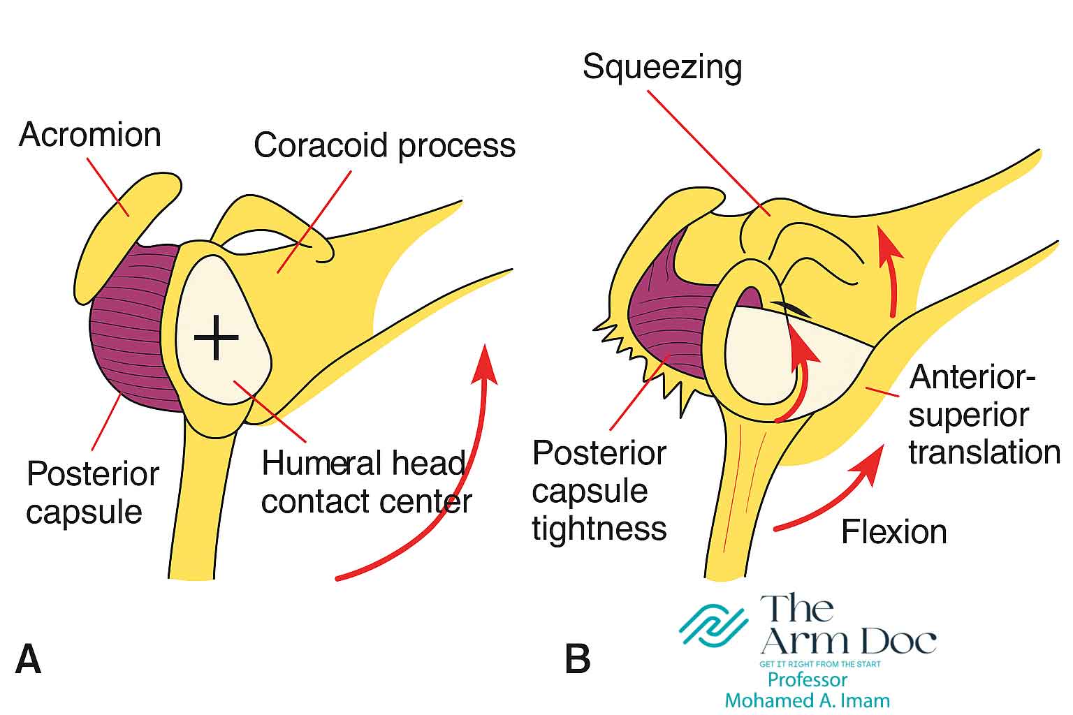 Shoulder Rotation Deficits Linked to Subacromial Pain in CrossFit Athletes