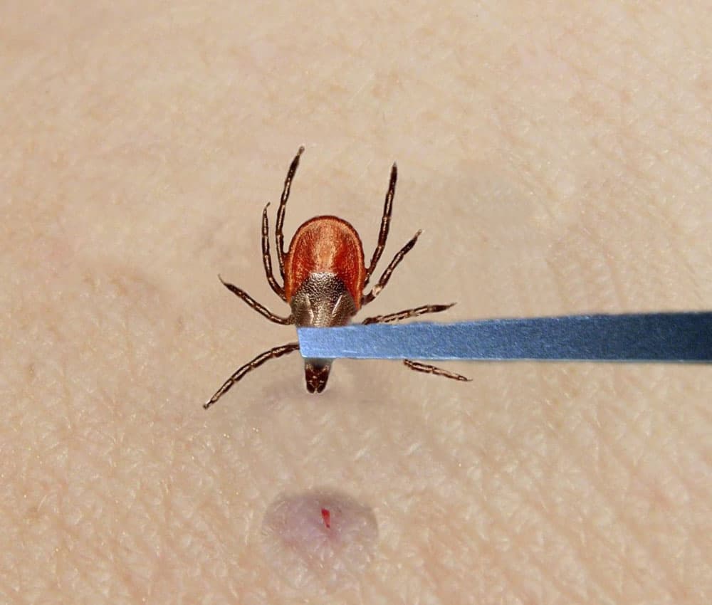 Snowy winter may fuel Suffolk County tick surge this spring
