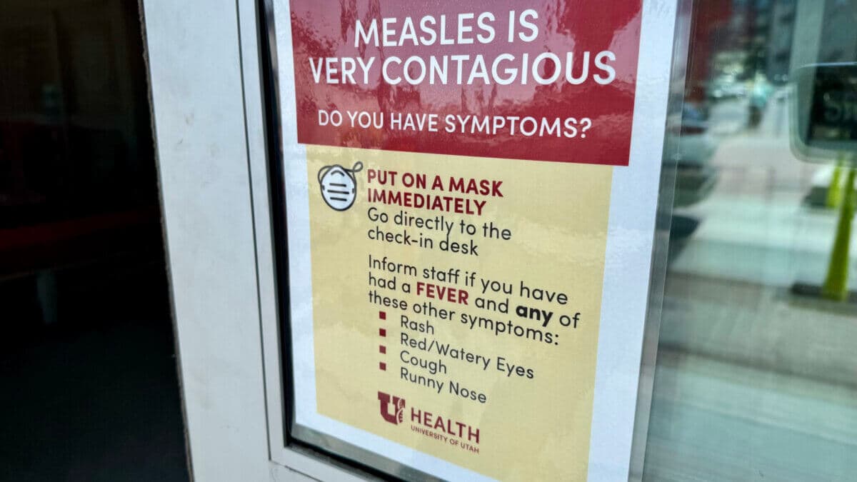Summit County Remains at One Measles Case as State Outbreak Expands