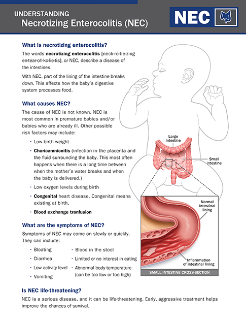 Judge Dismisses Abbott NEC Lawsuit, Citing Causation Gaps in Infant Formula Case