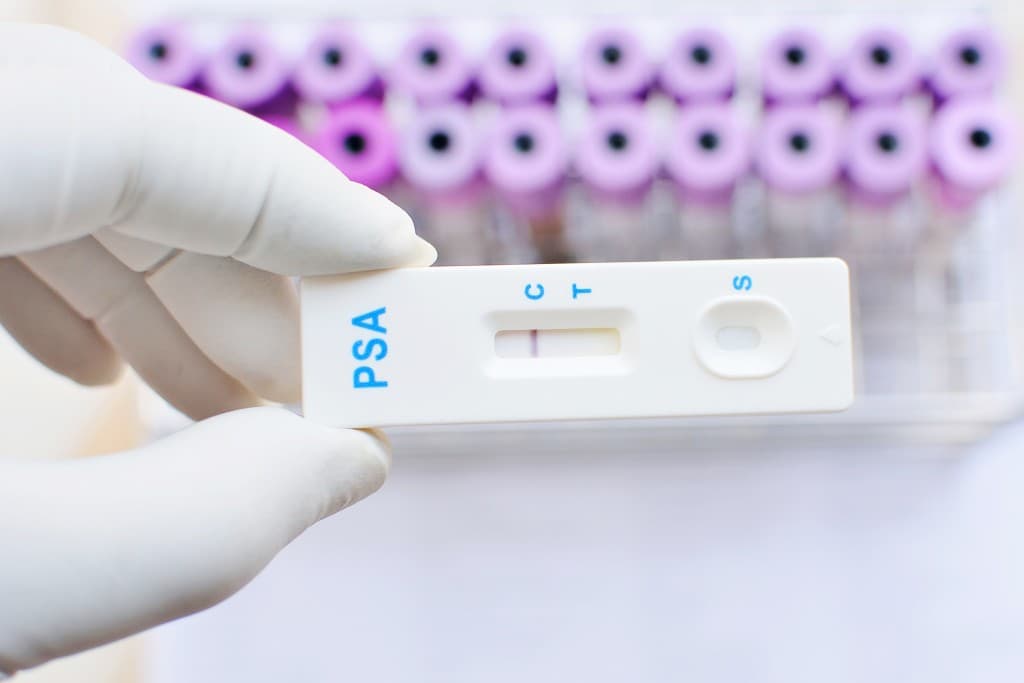 FDA Approves IsoPSA Blood Test, Aids Prostate Biopsy Decisions