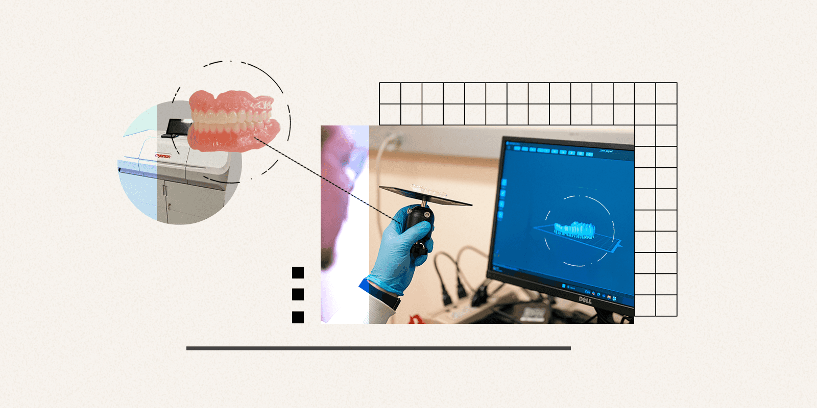 CU Anschutz explores multimaterial 3D printing for faster dentures