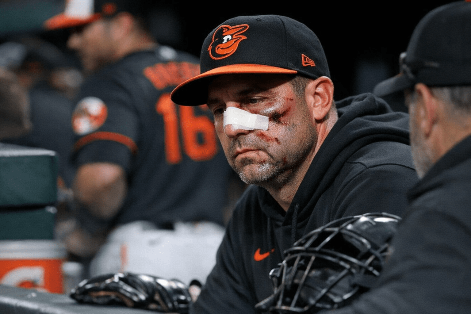 Orioles manager Craig Albernaz suffers seven facial fractures after dugout line drive
