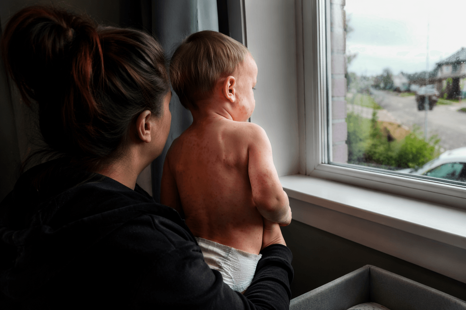 Pennsylvania measles outbreak grows as vaccination gaps hinder containment