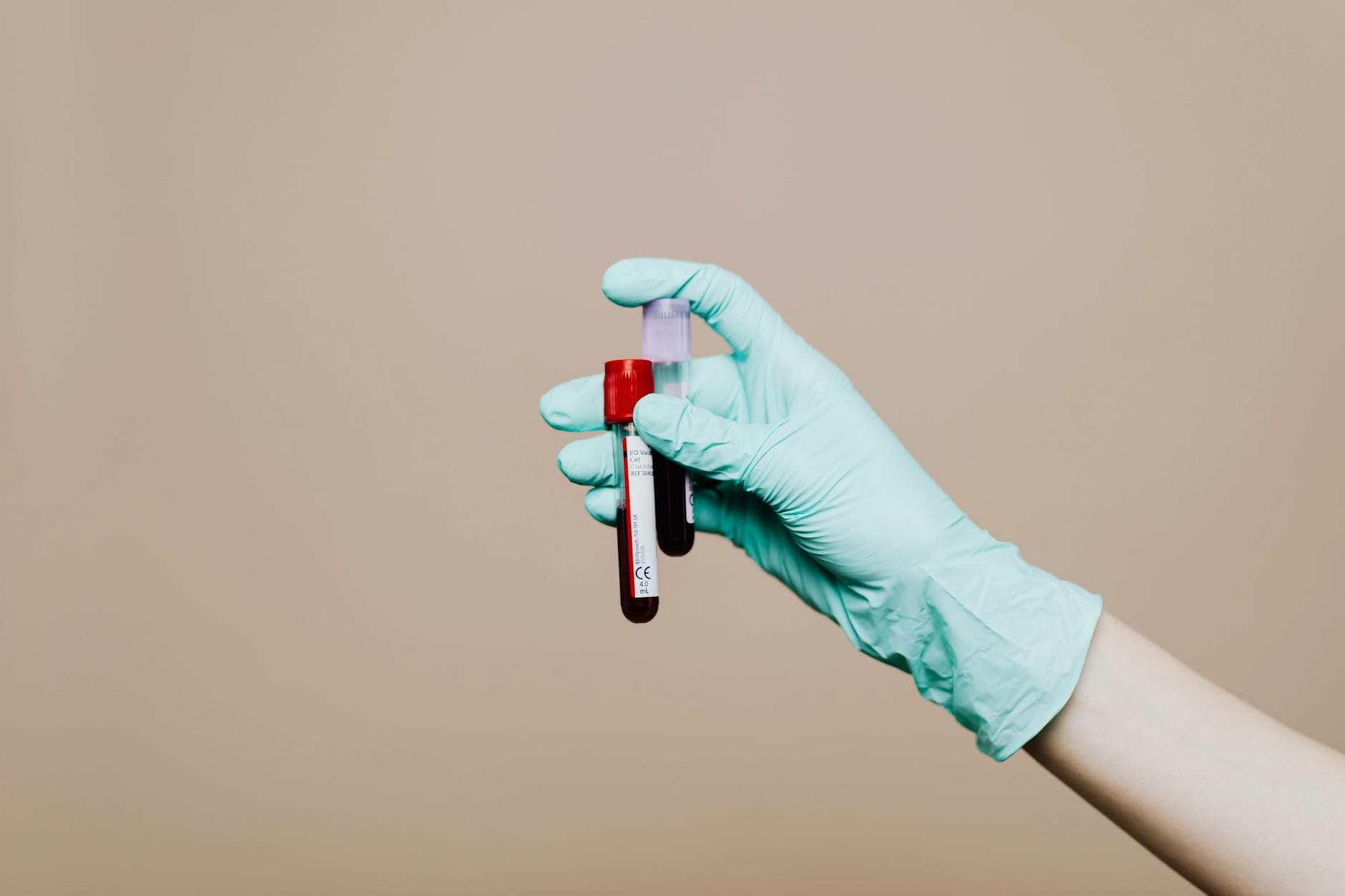 Blood test for tuberculosis nears key accuracy target, study finds
