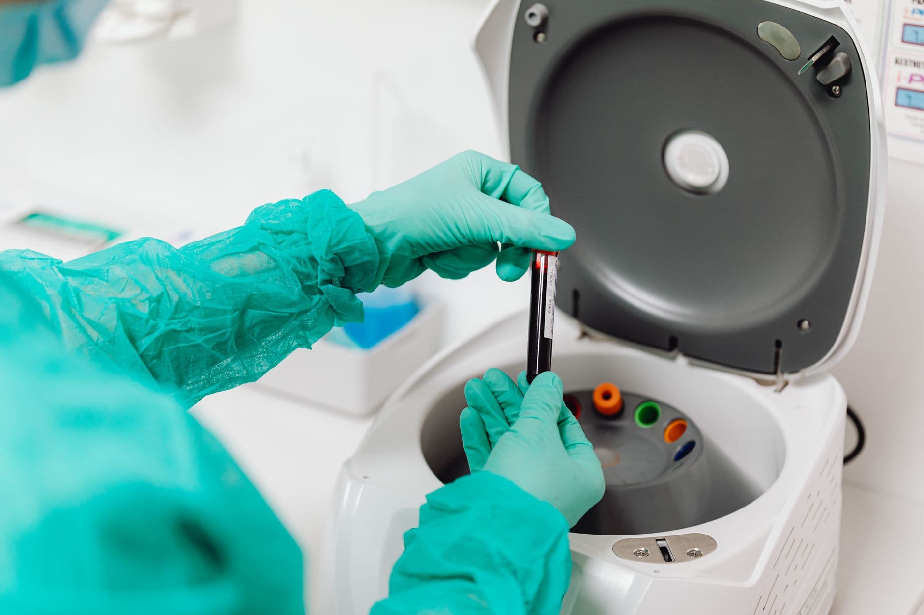 Blood tests for Alzheimer’s move closer to routine diagnosis
