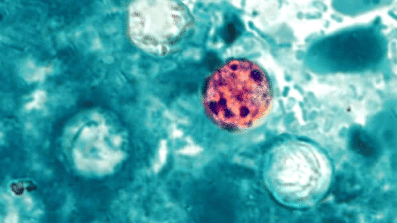 Buncombe County reports four cyclosporiasis cases tied to produce concerns