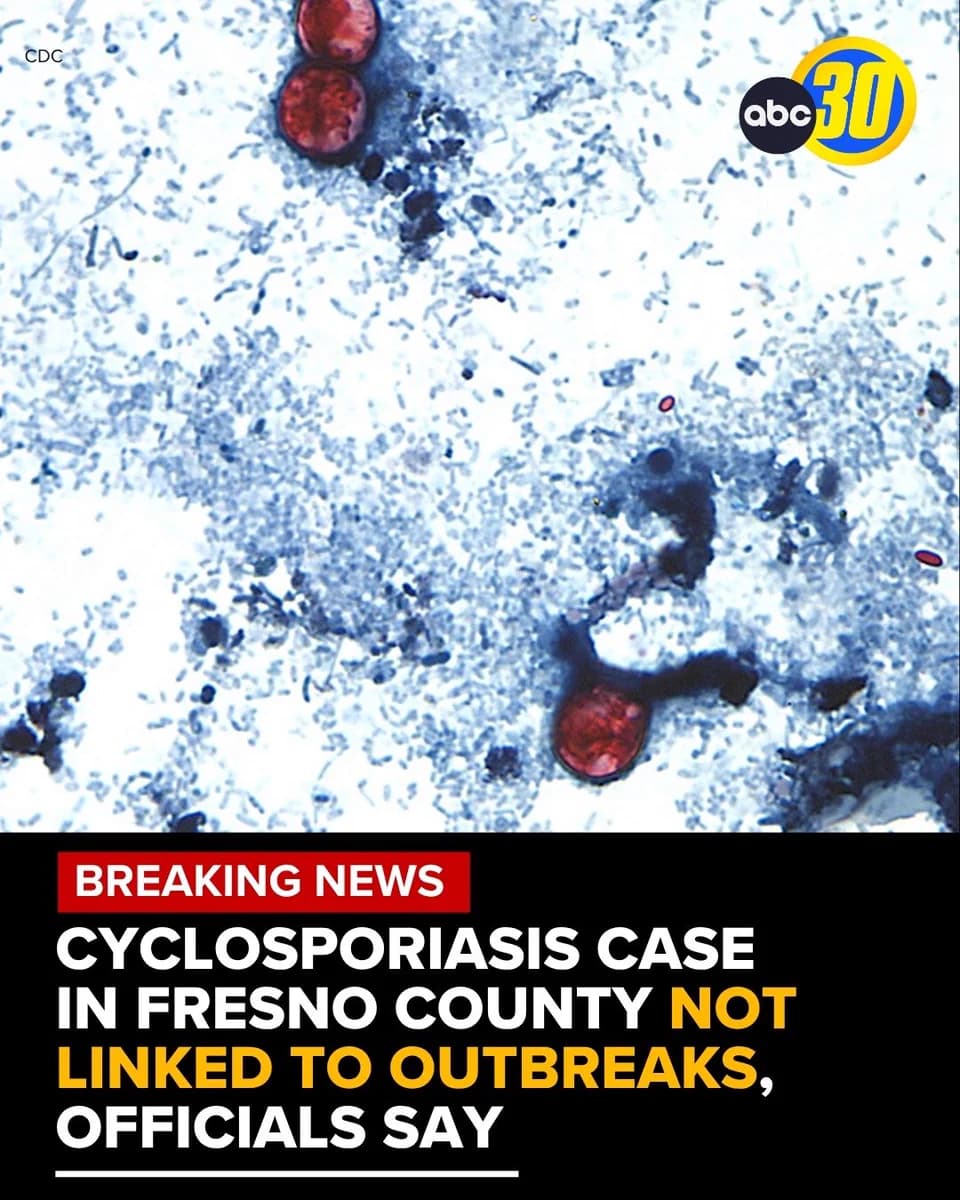 Fresno County confirms one cyclosporiasis case, not linked to outbreak