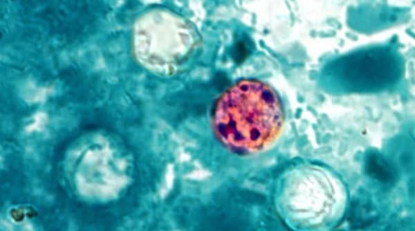 Adams County health officials investigate cyclosporiasis outbreak in residents