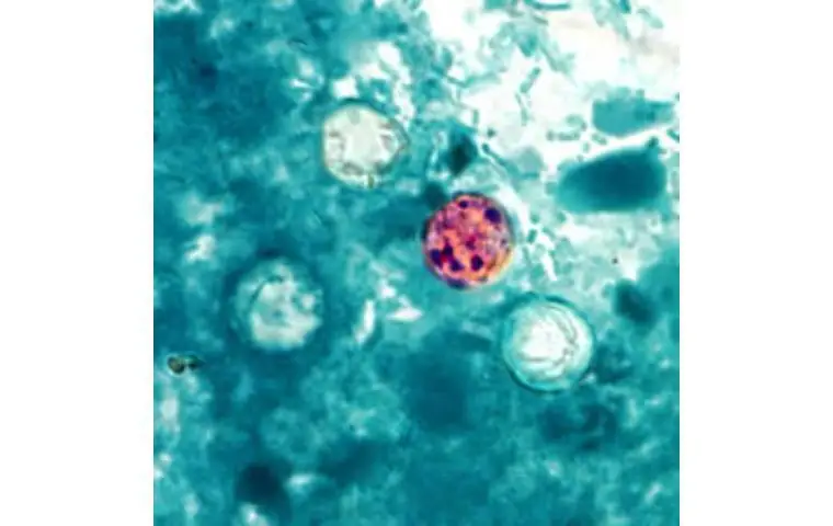 Hawaii confirms two more travel-related cyclosporiasis cases in residents
