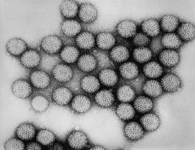 Rotavirus — Wikimedia Commons