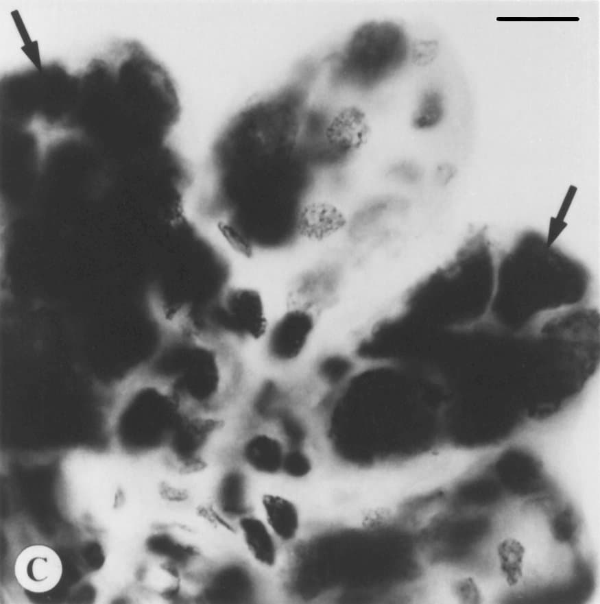 Powassan virus — Wikimedia Commons
