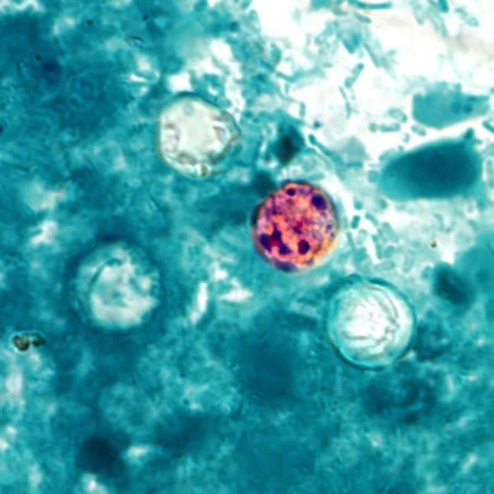 Michigan cyclosporiasis outbreak tops 700 cases, largest in state history
