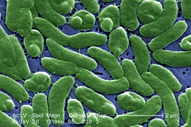 Vibrio vulnificus — Wikimedia Commons