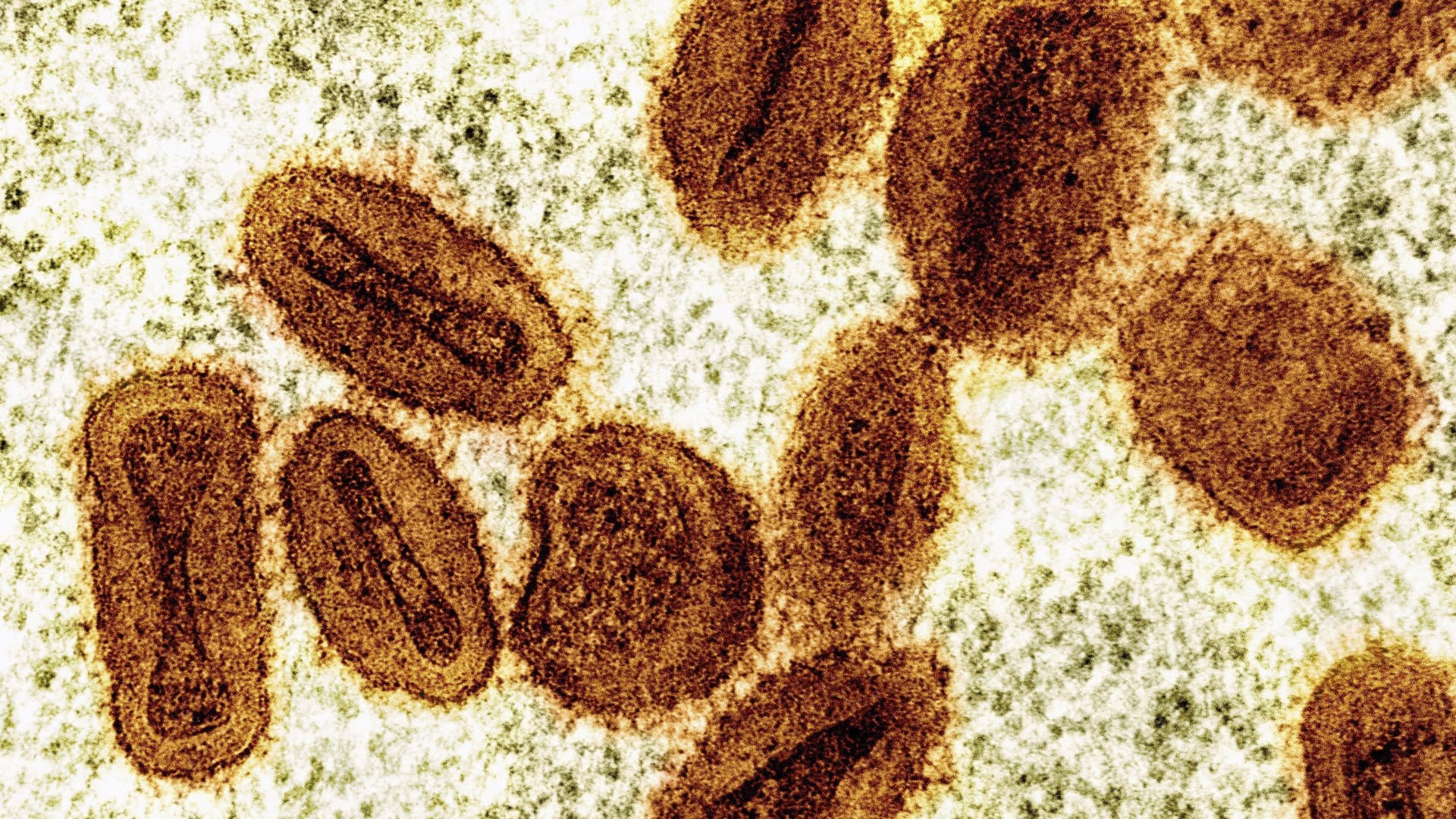 Two U.S. scientists charged with smuggling mpox samples from Africa
