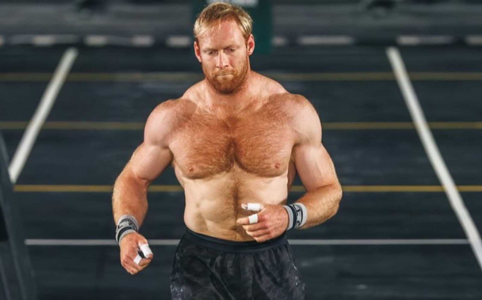 Pat Vellner Reports Recovery Progress One Day After Heart Ablation