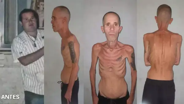 Released Cuban activist’s cancer worsened after four years in prison