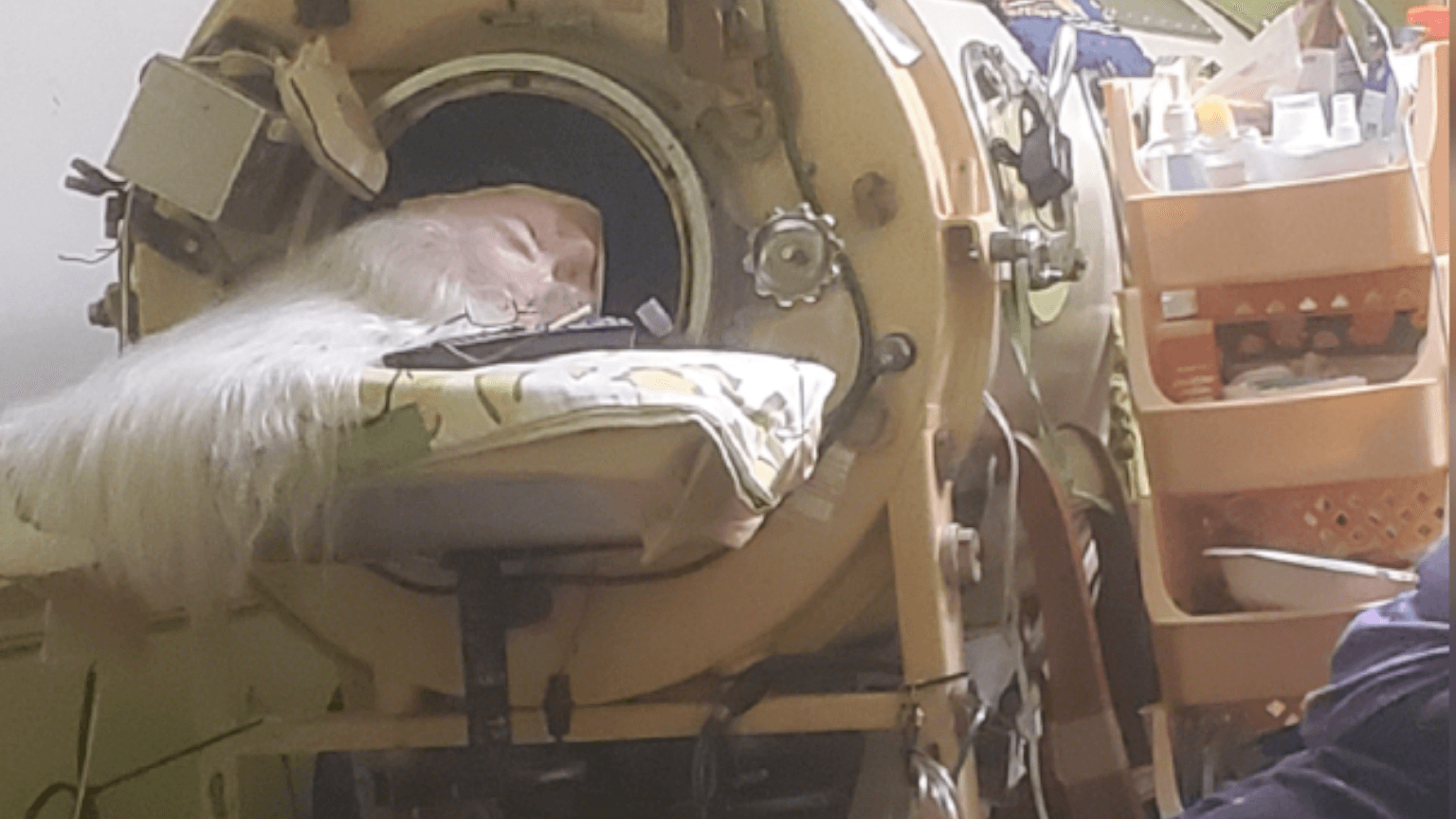 Last US polio patient to use iron lung dies at 78