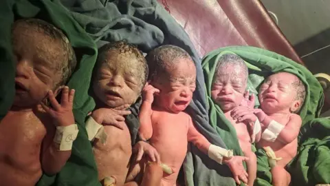 Ethiopian woman welcomes quintuplets after 12 years of infertility