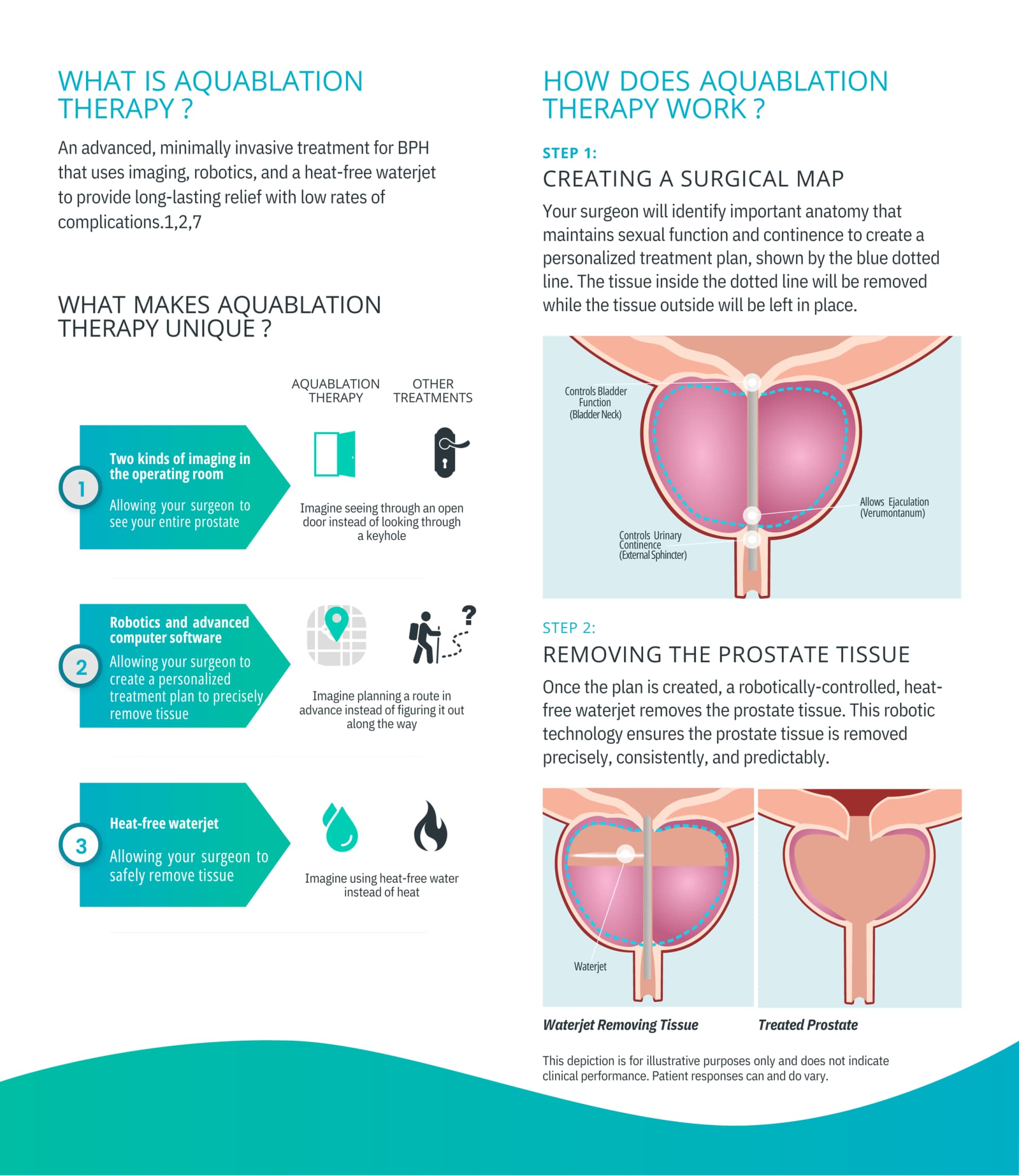 Garnet Health Hosts Free Aquablation Event, Educates Men on BPH