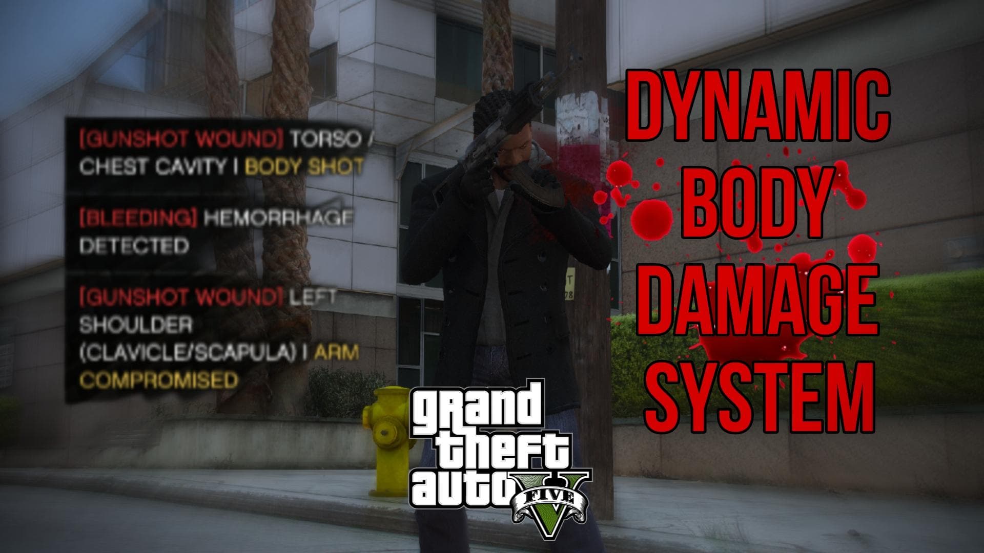 Dynamic Body Damage mod adds realistic wounds, bleeding and limping to GTA V