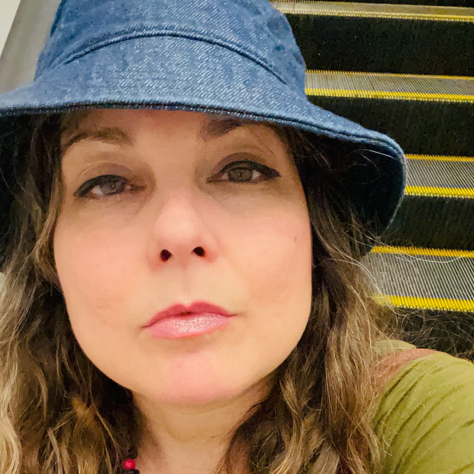 Bicyclist Struck by Truck in Inner Sunset Suffers Life-Threatening Leg Injury