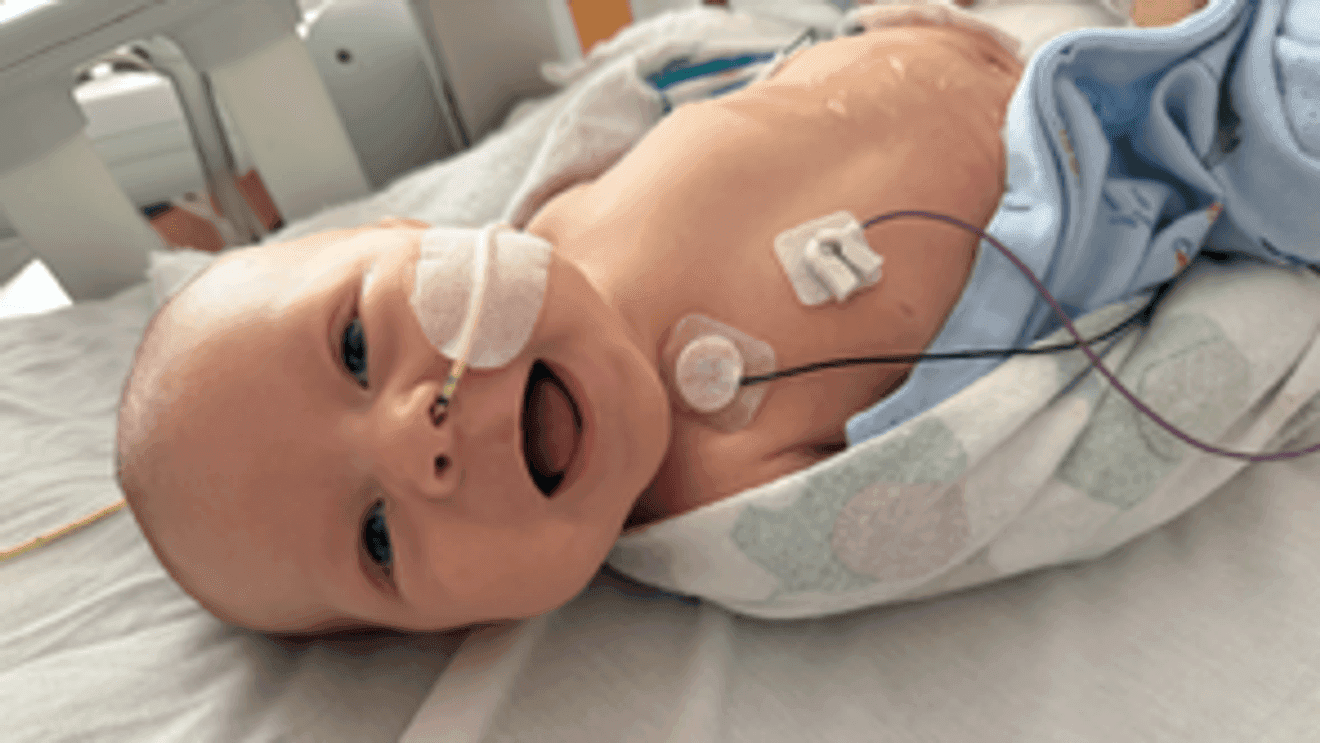 Fresno police officer’s newborn faces open-heart surgery at Stanford