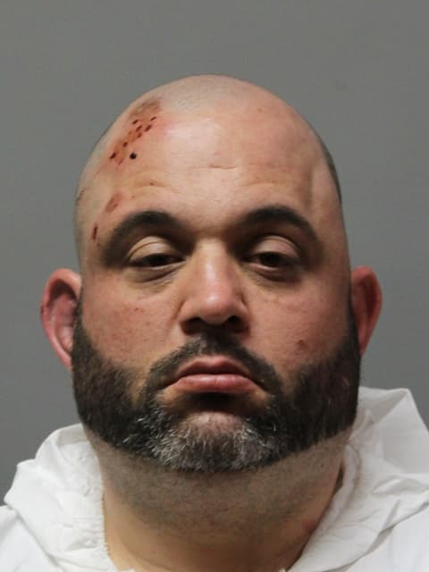 Copiague homeowner charged after alleged stabbing in leg assault