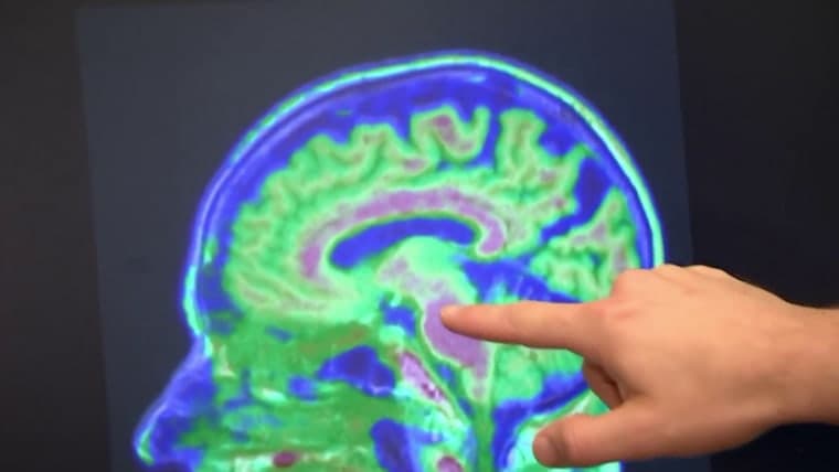 Mentally Active Sitting May Lower Dementia Risk, 19-Year Study Finds