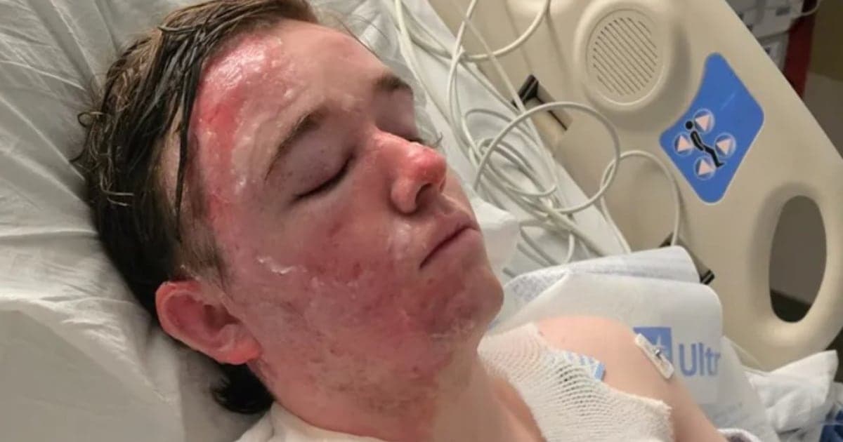 McDonald’s manager left in ICU after coworker allegedly throws hot oil