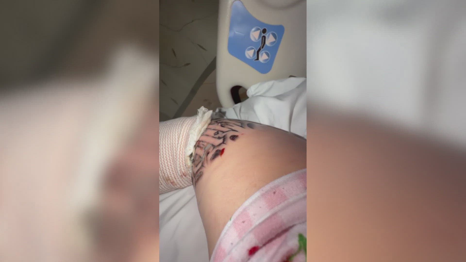 Phoenix woman says Instagram tattoo led to sepsis, two surgeries, hospitalization