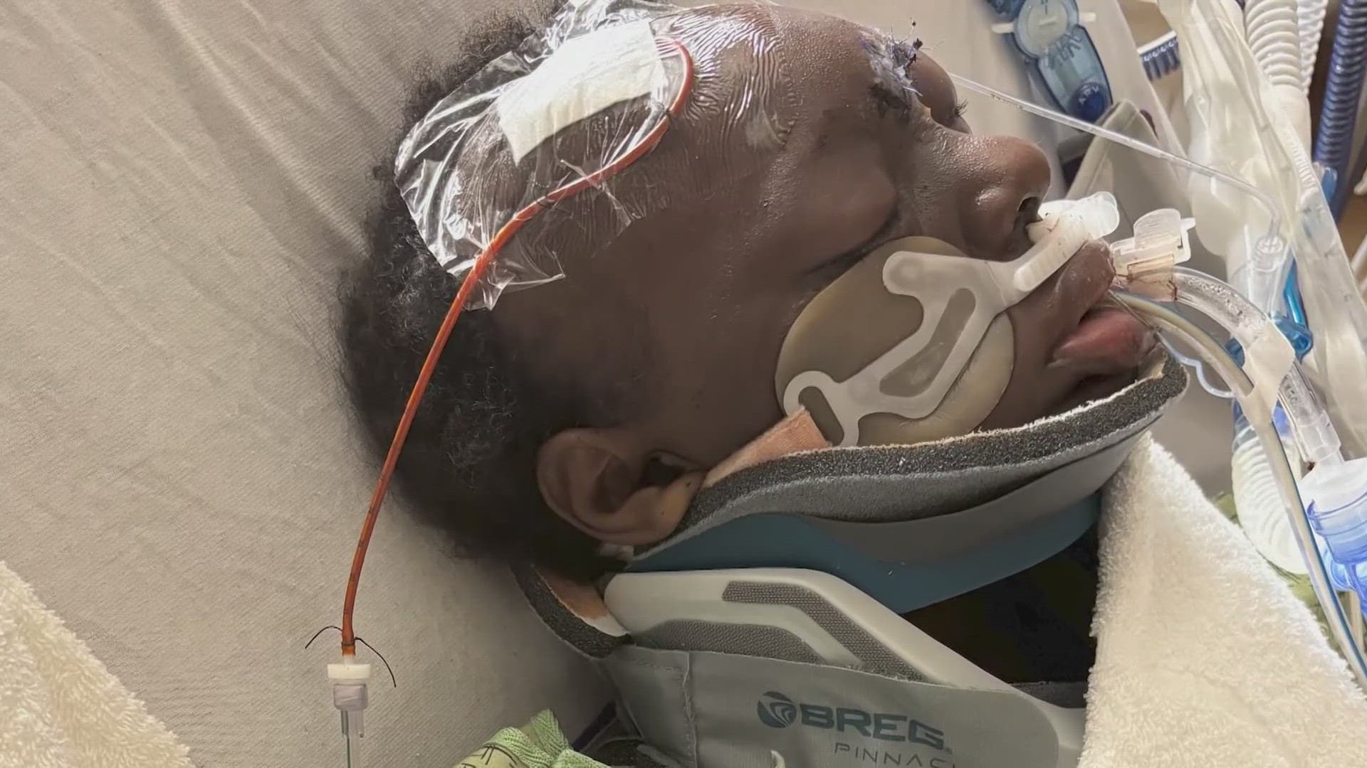 Woman Critically Injured in North Harris County Hit-and-Run, Family Seeks Tips