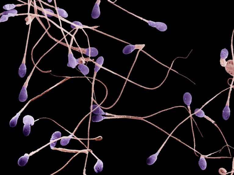 GLP-1 weight-loss drugs may boost testosterone and sperm quality in men