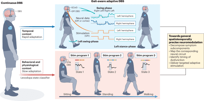 Adaptive neuromodulation improves Parkinsonian gait by targeting the right circuits