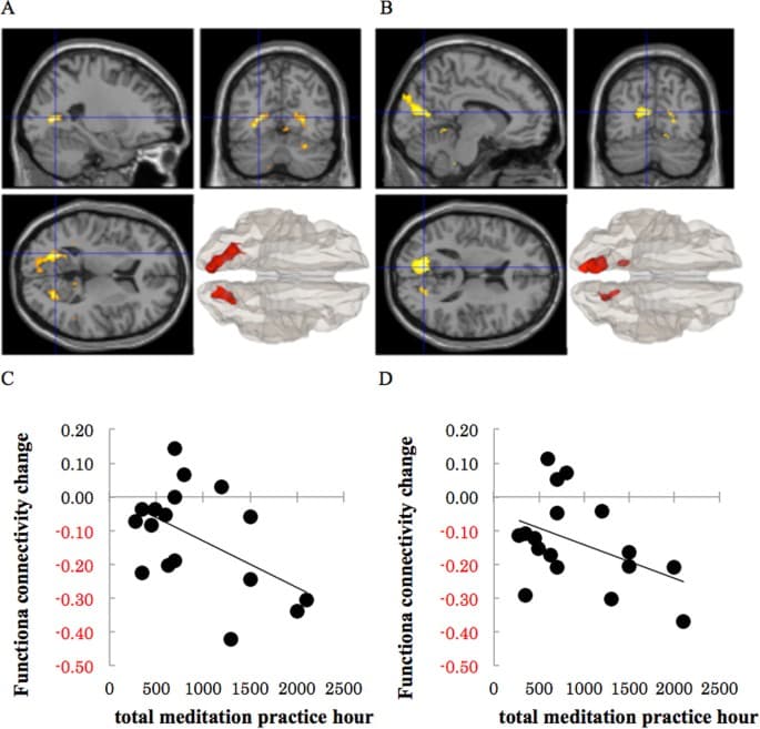 New study finds different brain pathways for meditation practices