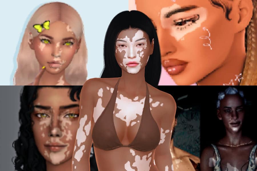 The Sims 4 vitiligo CC roundup expands skin details for every life stage