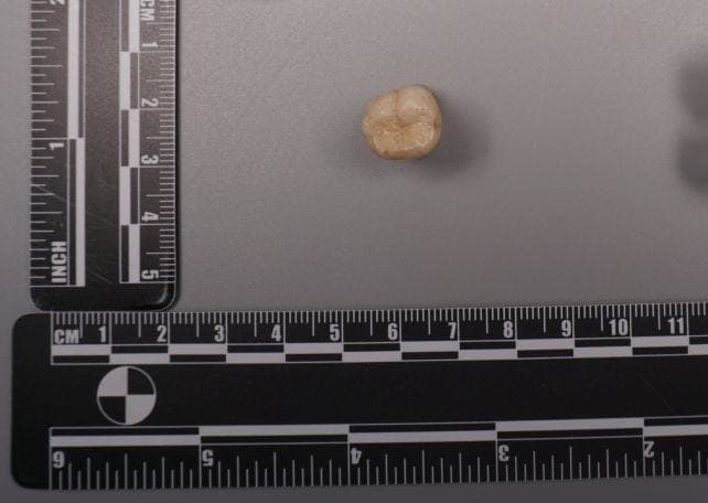 Related photo