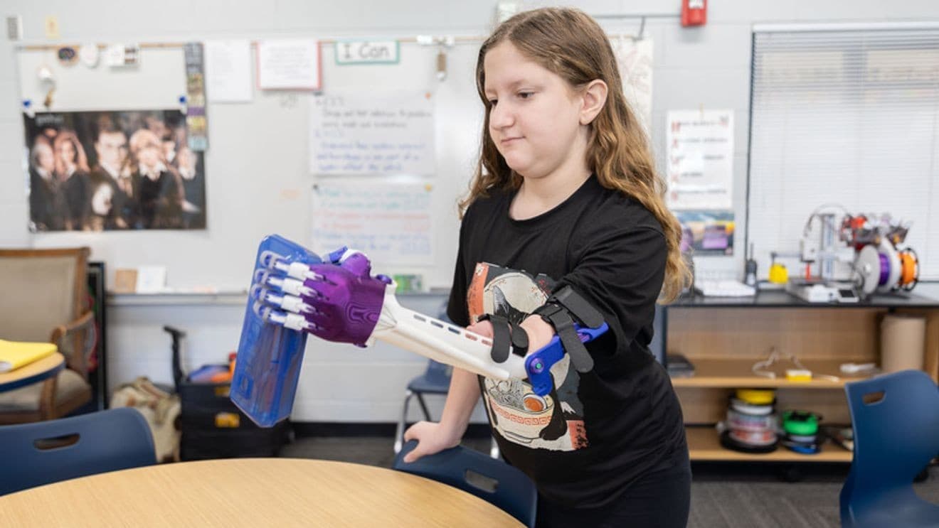 Buncombe County teacher 3D-prints prosthetic arms for children