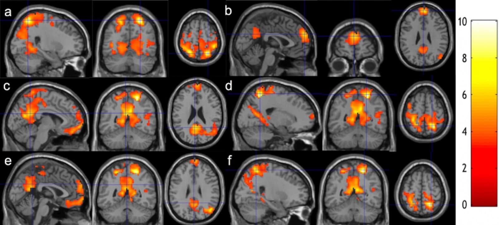Study Finds Micro-Meditations Can Change the Brain in Seconds